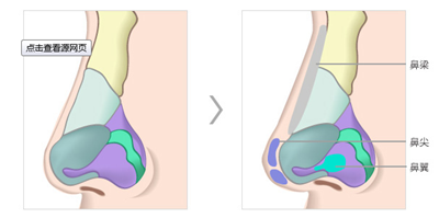 液體硅膠隆鼻 硅膠隆鼻